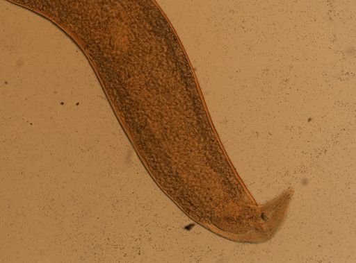 Enterobius vermicularis