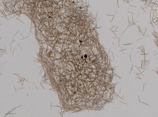 Haliclona (Soestella) caerulea