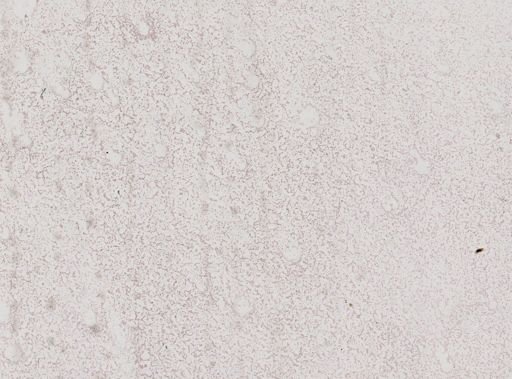 Plasmodium falciparum