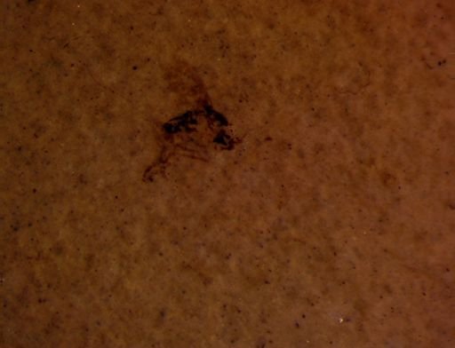 undet. Insecta