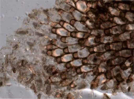 Bryozoa