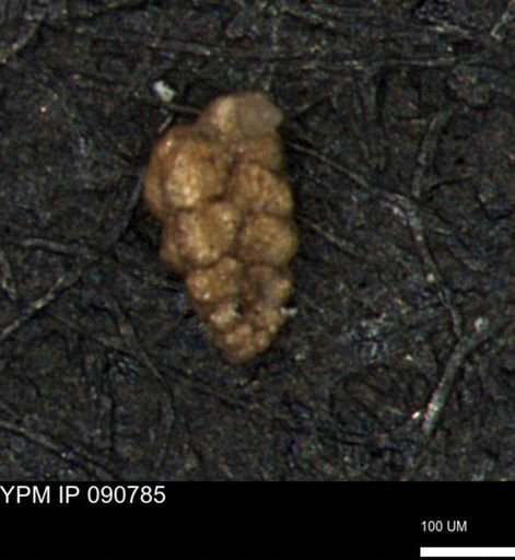 Verneuilina canadensis