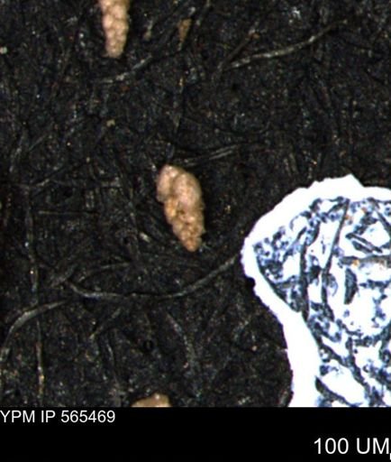 Verneuilina canadensis