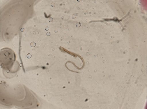 Nematoda