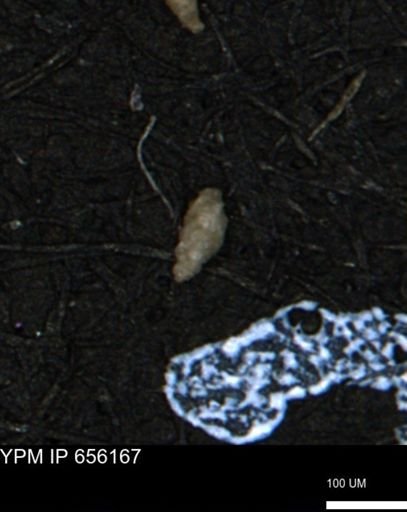 Verneuilina canadensis