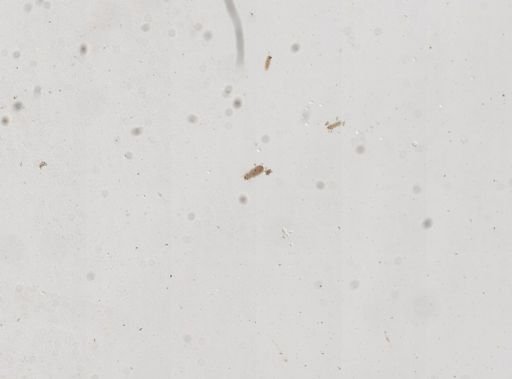 Clepsidrina polymorpha