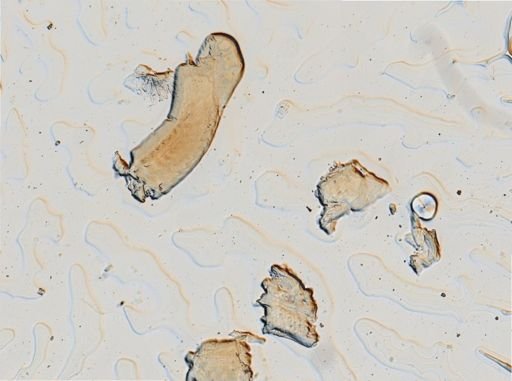 Onchidoris muricata