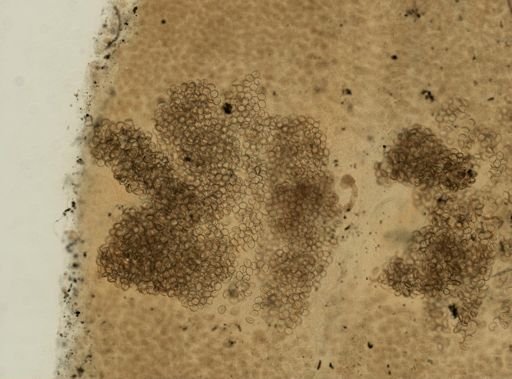 Diphyllobothrium latum