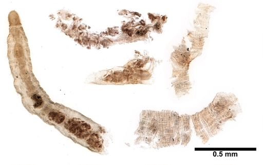 Adelodrilus anisosetosus