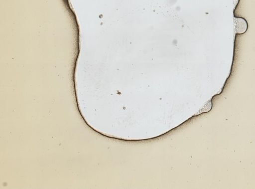 Lecane aculeata