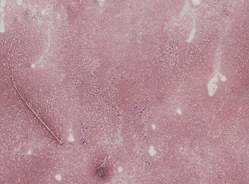Trypanosoma?