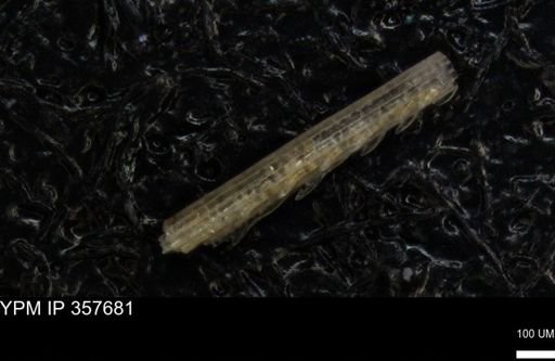 undet. Echinoidea