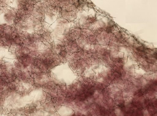 Haliclona