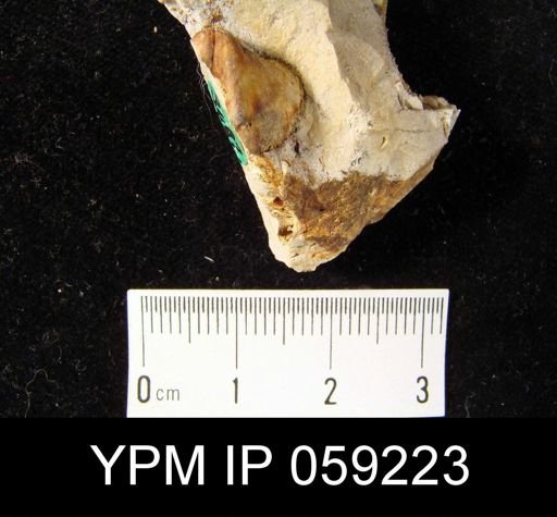 Metaplasia pyxidata
