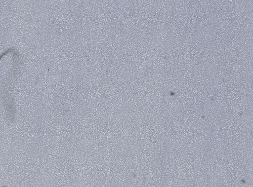 Plasmodium vivax