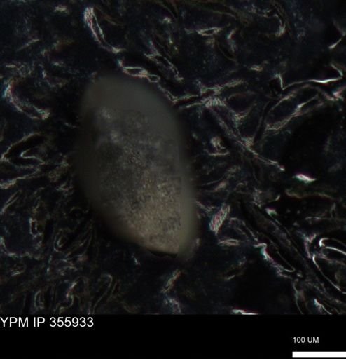 undet. Ostracoda