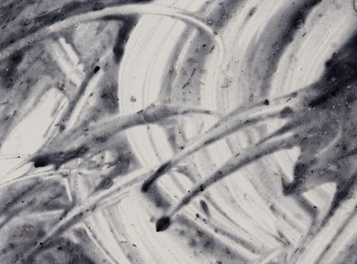 Entamoeba histolytica