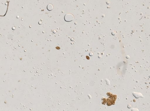 Diphyllobothrium canis