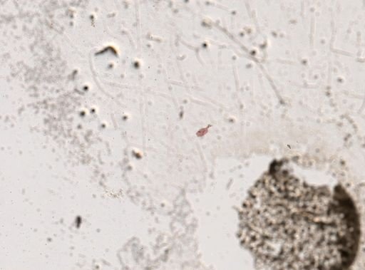 Paramecium