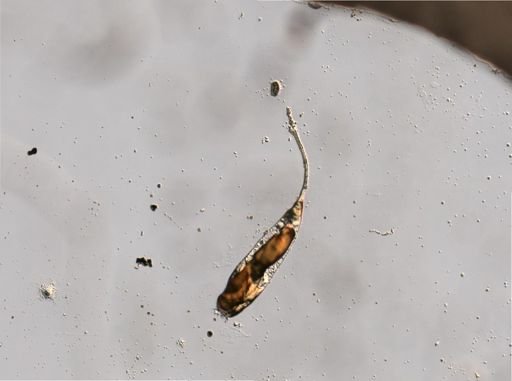 Trichocerca