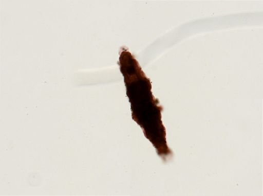 Dactylobiotus