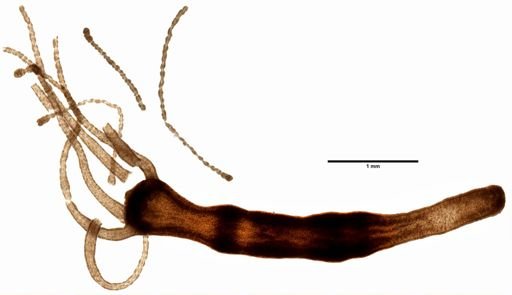 Hydra
