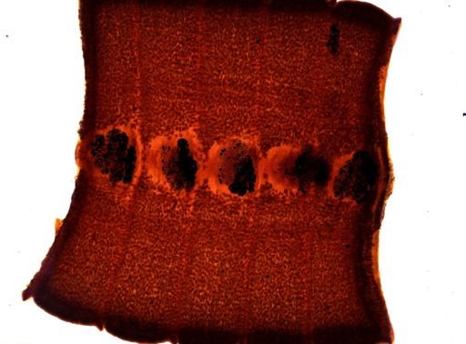 Diphyllobothrium erinacei