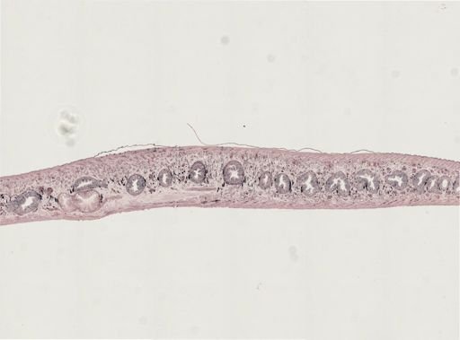 Turbellaria