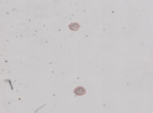 Lineus sanguineus