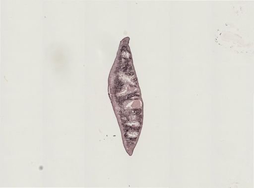 Foviella