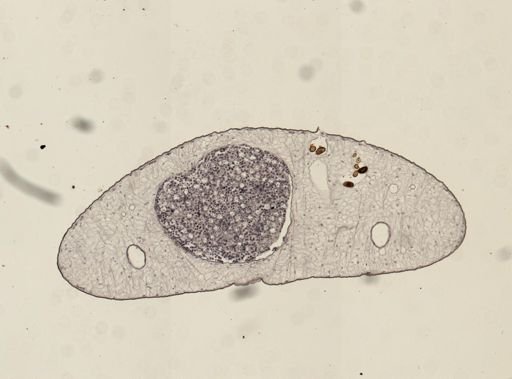 Dicrocoelium dendriticum