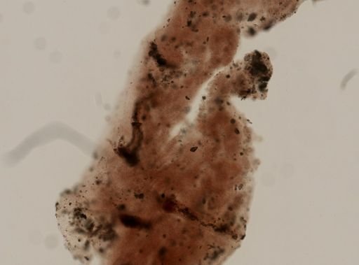 Dercitus sp.