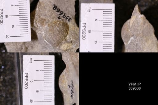 Cardium?