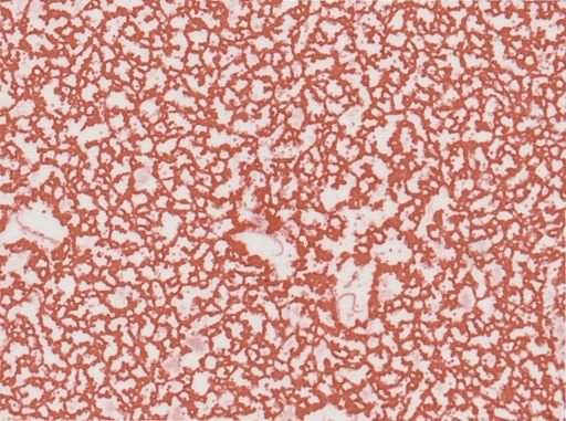 Dirofilaria immitis