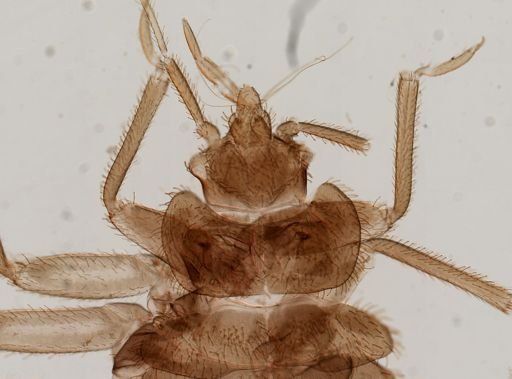 Cimex lectularius