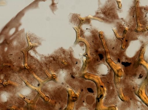 Aplysina cauliformis