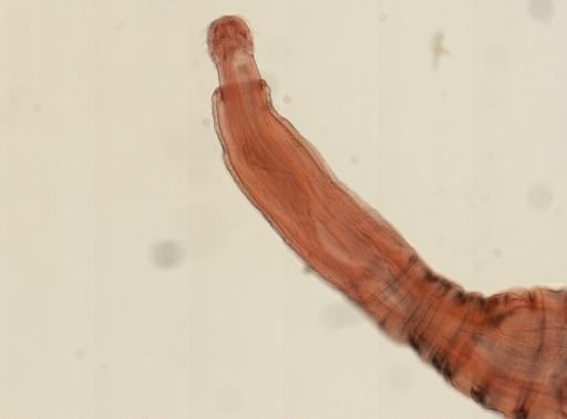 Oligacanthorhynchus microcephalus