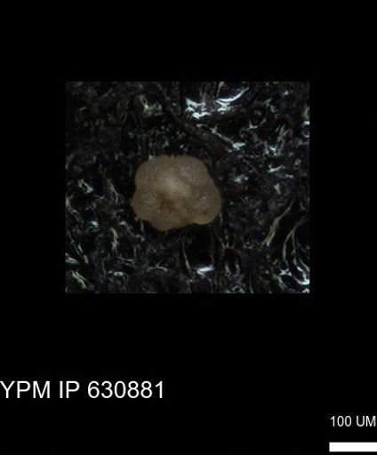 undet. Globigerinina