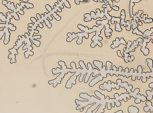 Sphaerularia bombi