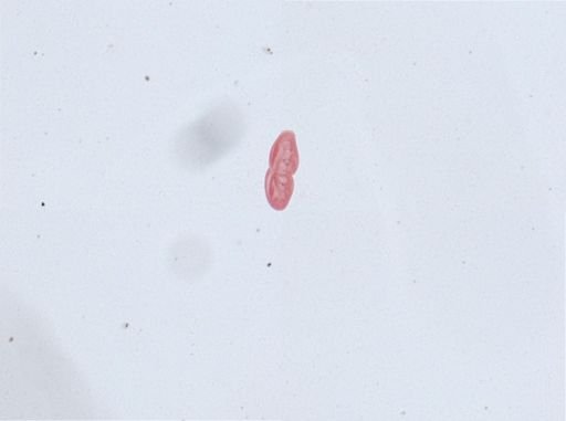 Paramecium aurelia