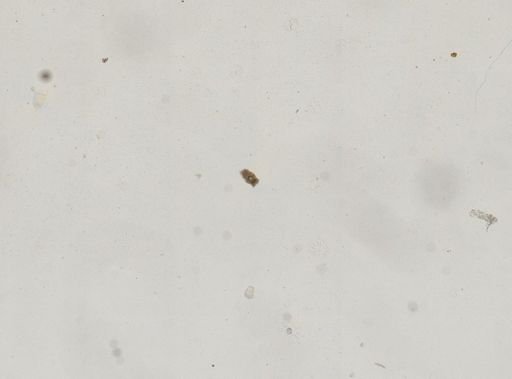 Keratella taurocephala