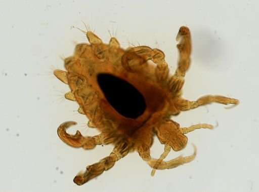 Pthirus pubis