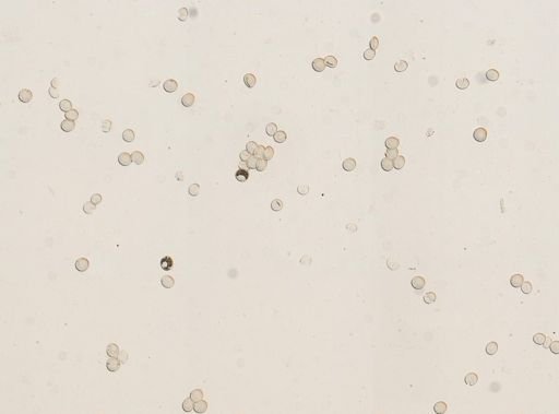 Taenia solium