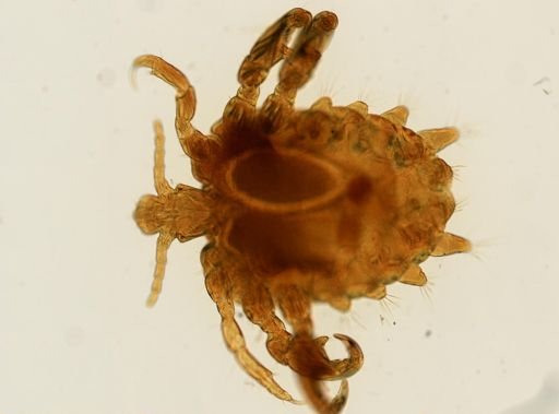 Pthirus pubis