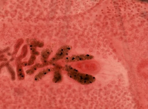 Diphyllobothrium latum