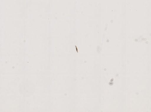 Paramecium