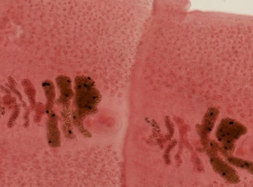 Diphyllobothrium latum