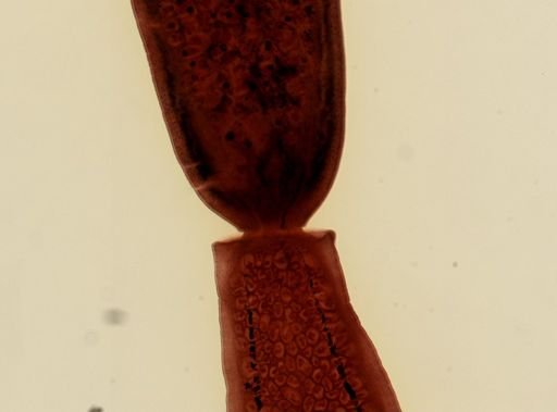 Dipylidium caninum