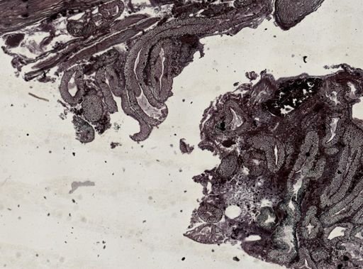 Callinectes sapidus