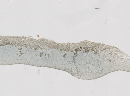 Pseudoceratina purpurea